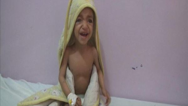 أكثر من مليون طفل يمني يدفعون ثمن الانقلاب
