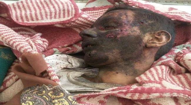 لحج:لغم حوثي يودي بحياة مدني في القبيطة