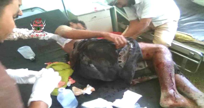 4 جرحى بينهم طفل بانفجار قذيفة حوثية استهدفت منزل في الحديدة