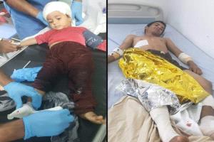 إصابة ثلاثة أطفال من أسرة واحدة بانفجار مقذوف حوثي شمال الضالع ..