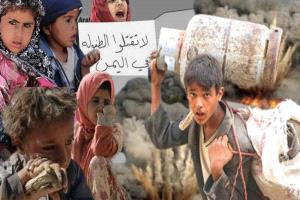 اطفال اليمن.. معاناة وألم 