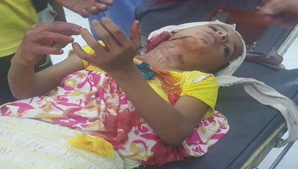 صور .. الحوثيون يستأنفون قصف لودر ويسقطون جرحى بينهم طفلة